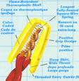 Solderless connector 33 -marret